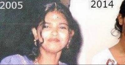 The 26 Year Old Is Beautiful. But Look At Her Face Today And You Won&rsquo;t Believe That Someone Could Do That To A Person.