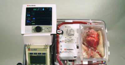 Unbelievable! Revolutionary Machine Brings Dead Hearts Back To Life