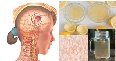 Natural Drink That Will Make Your Migraine Disappear In Just 10 Minutes!