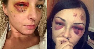 Thug Attacks Woman And Her Friend Who Had Been Pushing Her In A Wheelchair.