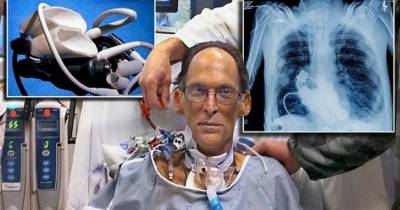 Meet The World's First Heartless Human, Living Without A Pulse