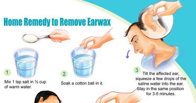 Easiest Ways To Get Rid Of Earwax At Home