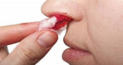 Does Your Nose Bleed For No Apparent Reason? Here&rsquo;s What May Be Causing It!