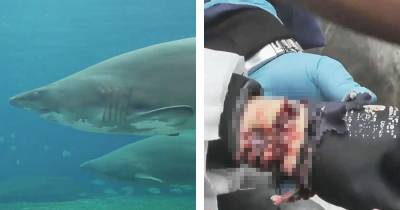 Diver Gets Attacked By Shark In Aquarium (GRAPHIC)