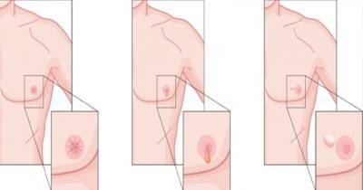 Early Symptoms Of Cancer Men Should Be Aware Of