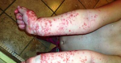 Kid Bounce Houses Are Not As Safe As You Might Think