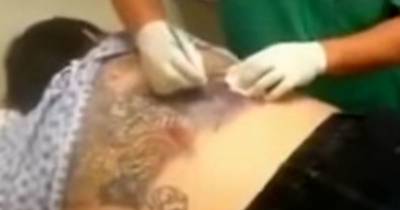 What Comes Out Of This Woman's Infected Tattoo Will Turn Your Stomach