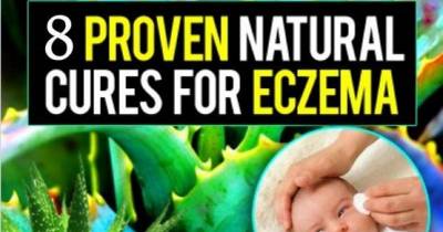 8 Natural Ways to Treat Eczema