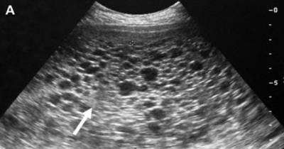 Wife Takes A Positive Pregnancy Test, But the Ultrasound Reveals It&rsquo;s Not A Baby That&rsquo;s In Her Womb