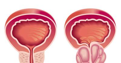 Warning Signs Of Colon Cancer You Should Not Ignore
