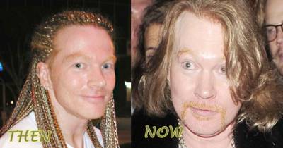 15 Good Looking Celebrities Who Destroyed Themselves with Plastic Surgery