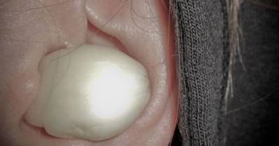 Watch What Happens When She Puts Garlic In Her Ear