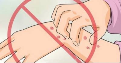 Finally, The Trick To Relieve Itchy Hands And Feet At Night