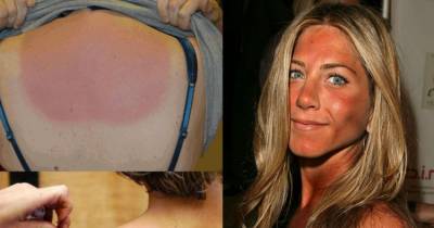 What Does Tanning Say About Your Body?