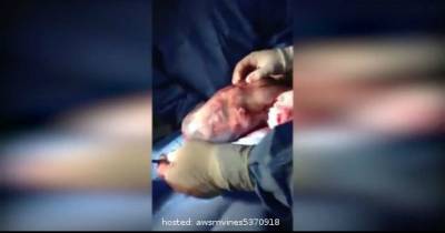 Mom Expected Normal Childbirth, But When The Doctors Get Excited, She Can't Believe It