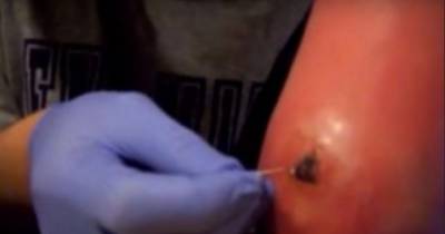 He Got Bit By A Spider. When I Saw What Happened After He Pricked Himself? I Was TERRIFIED!