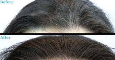 This Remedy For Graying And Losing Hair Is So Simple You Won't Believe You Haven't Been Using It.