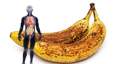 The Health Benefits Of Eating Black-Spotted Bananas