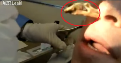 Doctor Removes Booger From Hell From Inside Man's Nose
