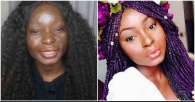This Burn Survivor Turned Herself Into Amazing Makeup Artist