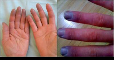 You Shouldn't Ignore Your Cold Feet And Hands. They Could Be Signs Of Severe Illness.