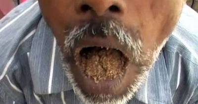 World's Freakiest Eater? Man Dubbed 'Sandman' Spends 25 Years Scoffing Gravel