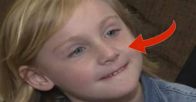 Doctors Discover Unbelievable Object In 5 Year Old Girl's Nose