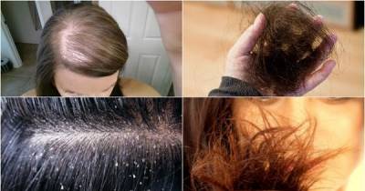 Stop Ignoring The Warning Signs Your Hair Is Sending! These Symptoms May Indicate A Serious Condition!