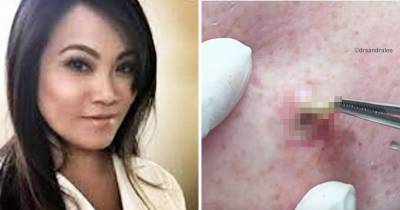 The Dr. Behind The Nasty Popping Videos Created Her &lsquo;Greatest Pops&rsquo;