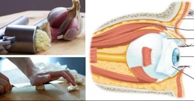 How To Use Pressed Garlic To Reverse Vision Loss Without Glasses Or Surgery