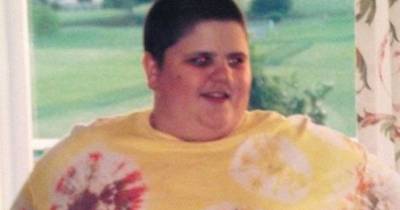 Brutal Bullying Made Him Lose 160 Pounds In A Year, You Won't Believe What He Looks Like Now!