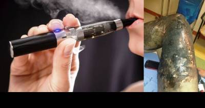 Teen Suffers Horrific Burn Injuries From An Exploding Vape Pen