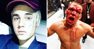 Nate Diaz Responds To Justin Bieber Talking Trash On Instagram