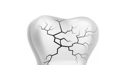 A Dentist Once Wrote About A Condition That Caused People's Teeth To Explode