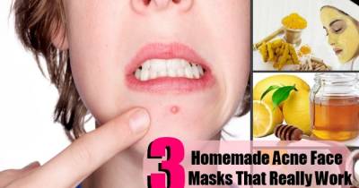 Top DIY Homemade Acne Face Masks