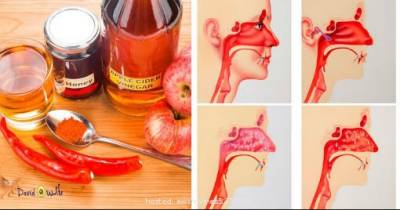 This Is What Apple Cider Vinegar Does For A Sinus Infection!