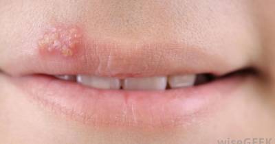 Warning: Even A Condom Cannot Protect You From This Lethal Disease It's Worse Than HIV!