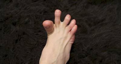 This Is Why The Bottom Of Your Foot Randomly Cramps Up
