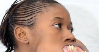 Little Girl Has Monster Face Tumor Removed