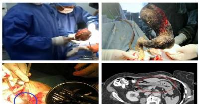 Gut-Wrenching Things Doctors Have Found In People's Stomachs