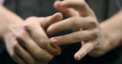 Here's What Happens To Your Knuckles When You Crack Them