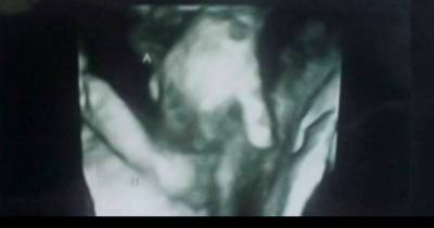 Pregnant Mom Gets Tragic News From Her Doctor. Then She Takes a Closer Look At The Sonogram...
