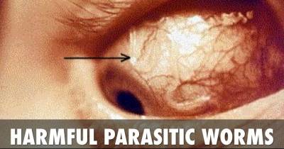 Terrifying Diseases Caused By Parasites In Your Eyes