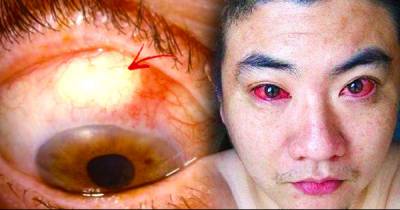Man Diagnosed With Eye Cancer Because Of Doing This At Night! Are You Making The Same Mistake?