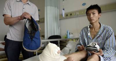 Man Whose Foot Swelled To The Size Of A Bowling Pin Undergoes Life-Changing Operations And Reveals Results