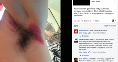People Say They Are Suffering &ldquo;Severe Rashes&rdquo; From Using Old Spice Deodorant