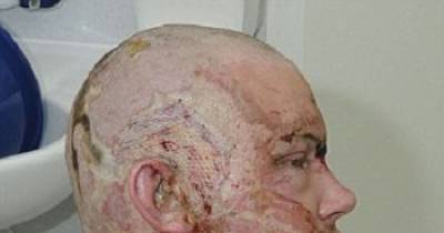 OMG! Road Rage Motorist Sprayed Acid On The Face Of An Innocent Motorist And Was Sentenced To 17 Years.