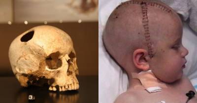 Impossible Surgeries That Will Leave Your Mouth Open