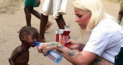 Remember The Boy Who Nearly Died Of Hunger? SEE HOW HE LOOKS TODAY!