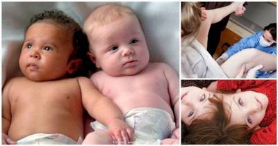 Surprising Facts You Didn't Know About Twins